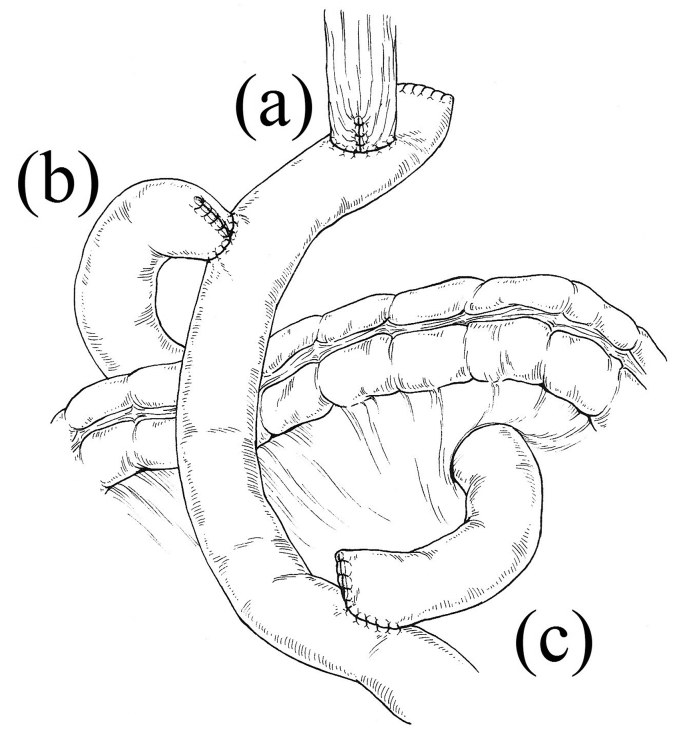 Fig. 1