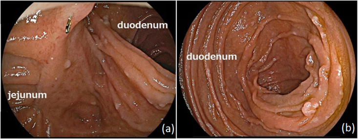 Fig. 2