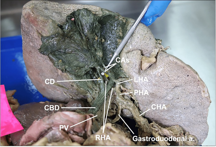 Figure 11