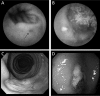 Fig. 1