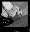 Fig. 2