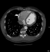 Fig. 3