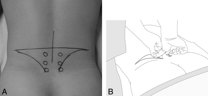 Fig 1.