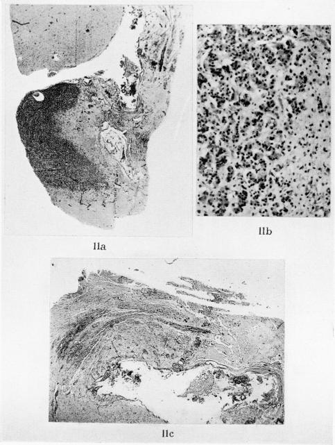 Fig. 11