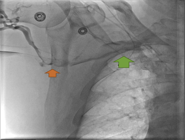 Fig 1