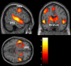 Fig 5
