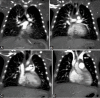 Figure 11(A-D)