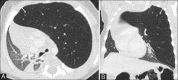 Figure 6(A and B)