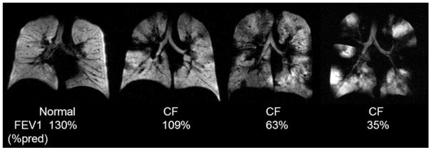 FIG. 22