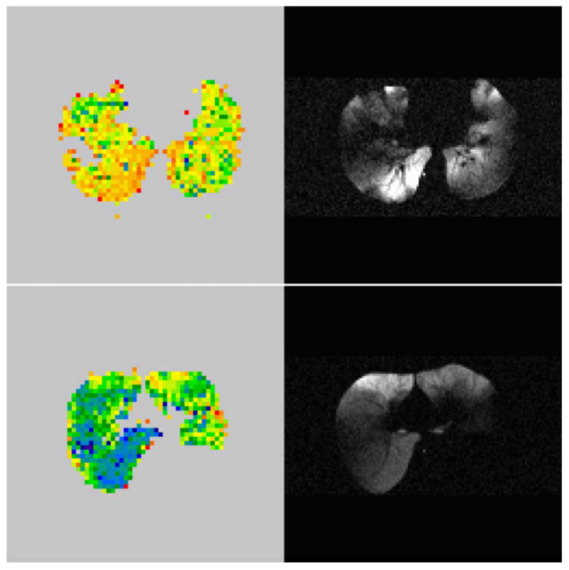 FIG. 23