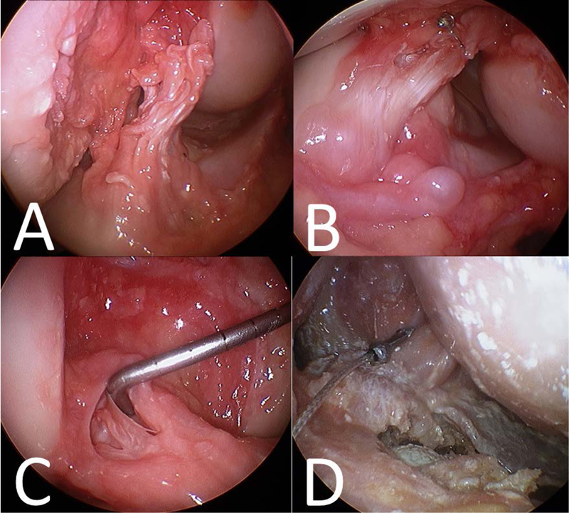 Figure 2: