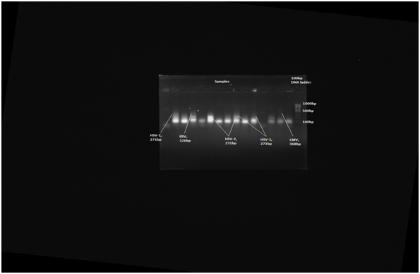 [Table/Fig-1]: