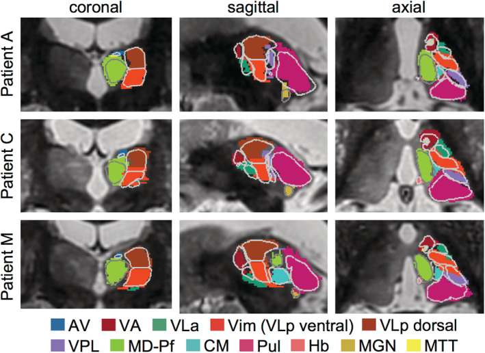 FIGURE 4