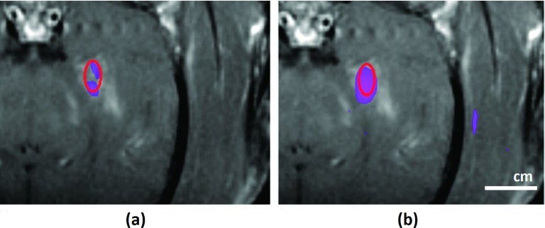 FIG. 11.