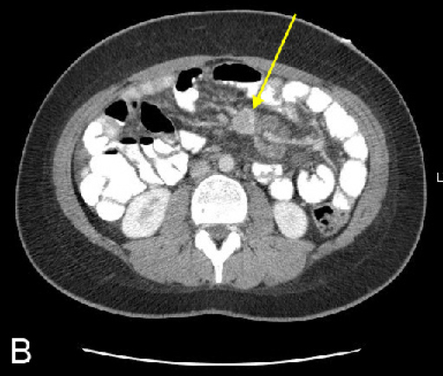 Figure 1B