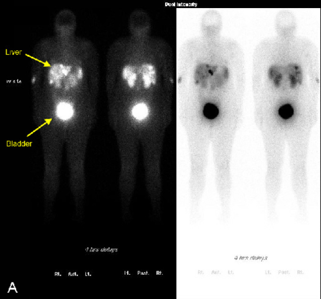 Figure 3A