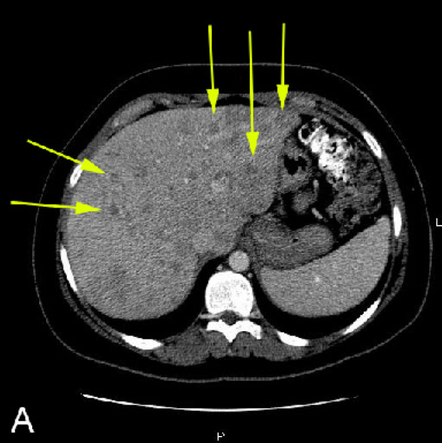 Figure 1A