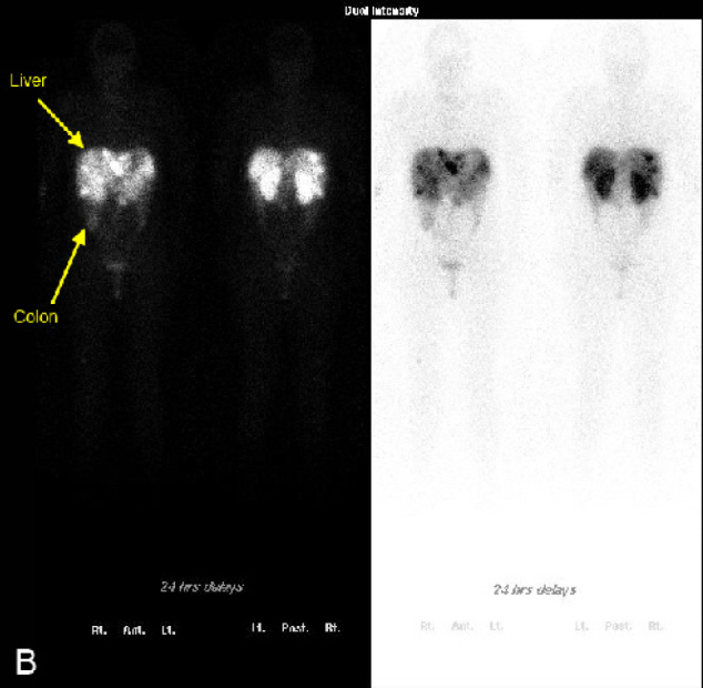 Figure 3B