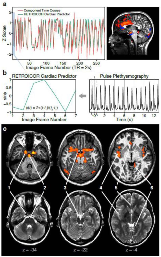 Fig. 4