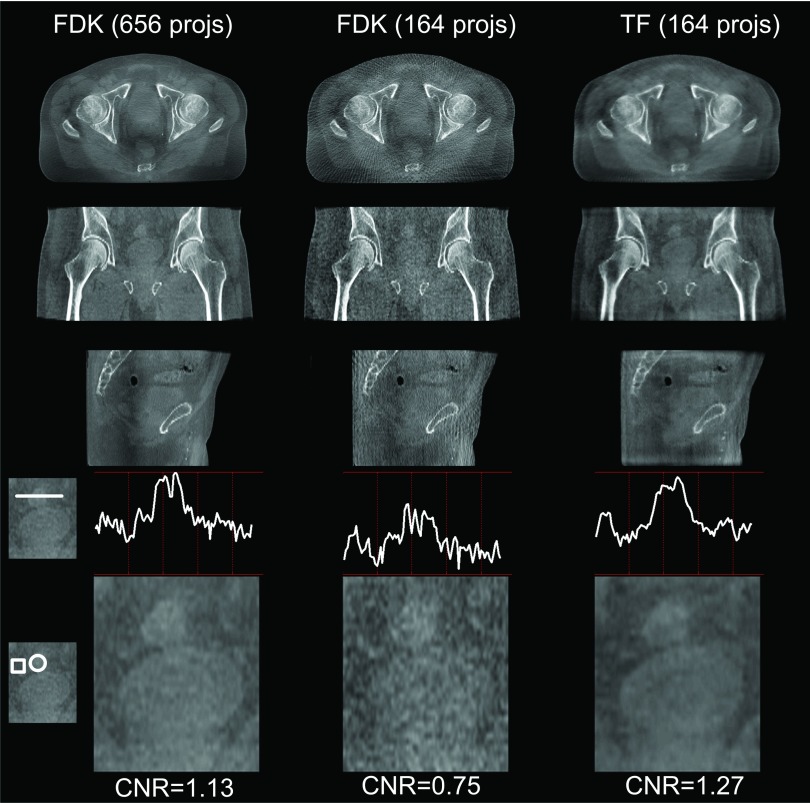 FIG. 11.