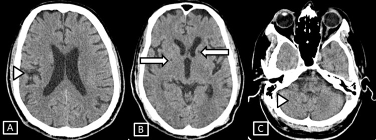 Figure 7