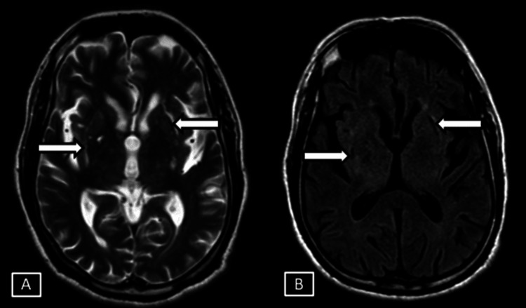 Figure 10