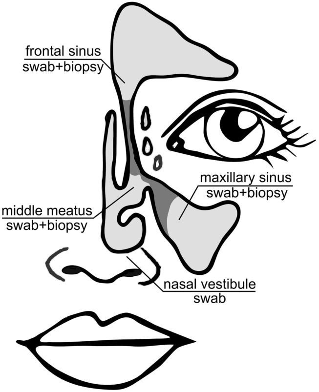 Fig. 1