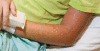 Figure 2)