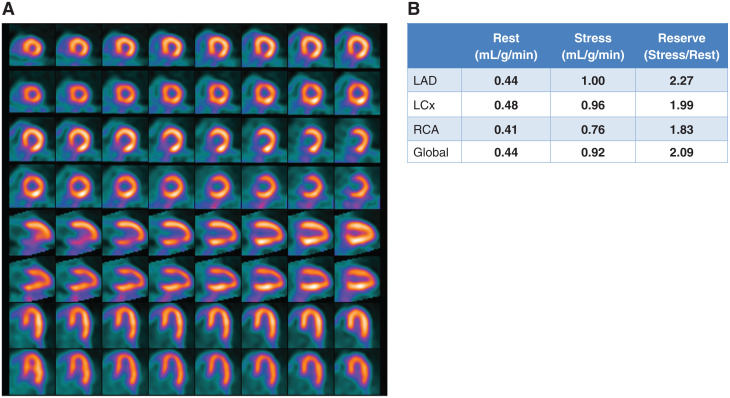 Figure 11.