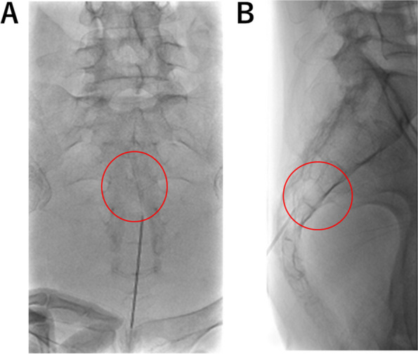 Fig. 2