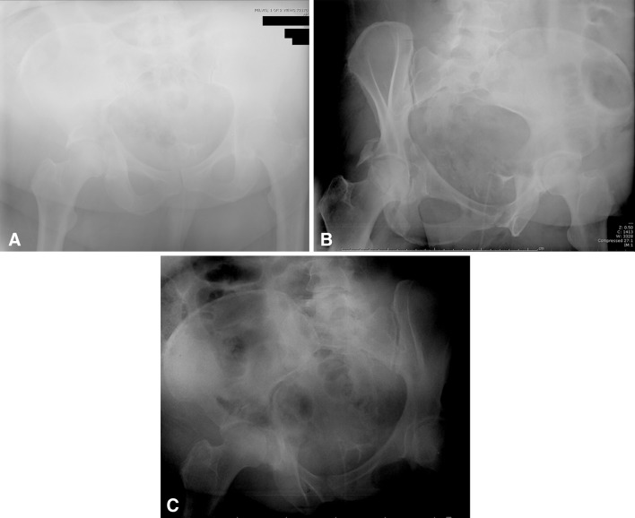 Fig. 1A–C