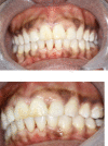 Fig. 5 (a and b)