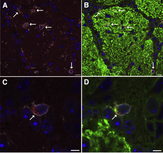 Figure 11