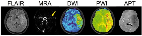 Figure 4.