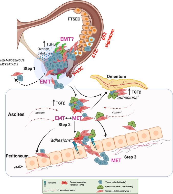 TGFβ signaling networks in ovarian cancer progression and plasticity - PMC