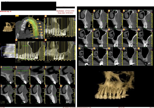 Figure 33