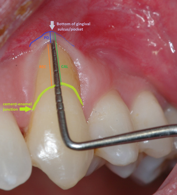 Figure 26