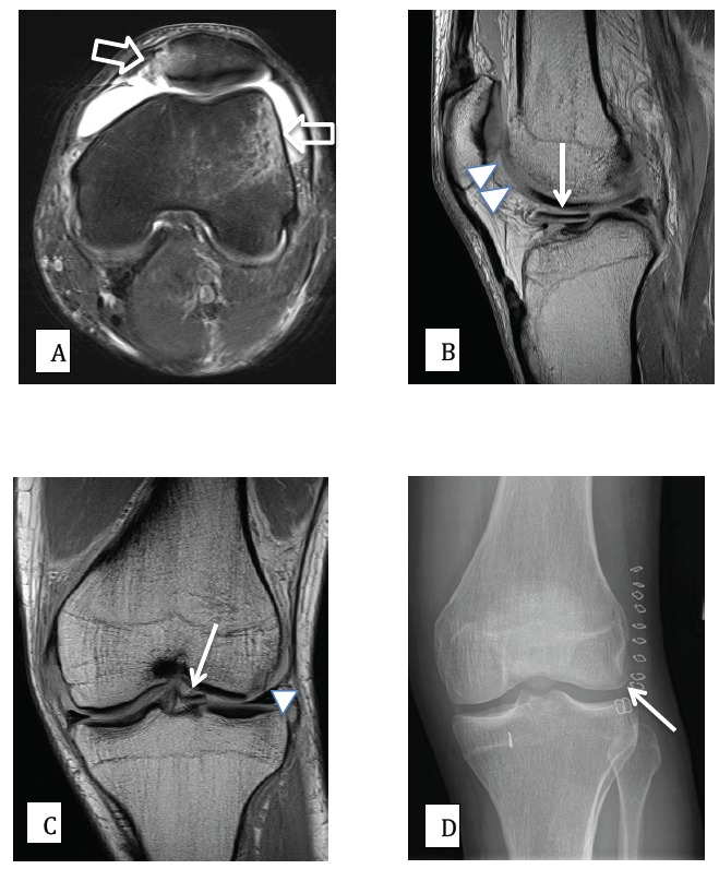 Fig. (5)