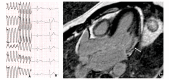 Fig. (3)