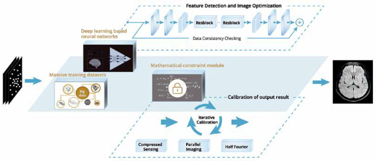 Deep learning and AI in reducing magnetic resonance imaging scanning ...