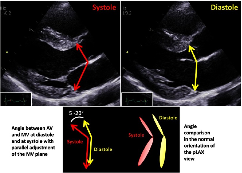 Figure 11.