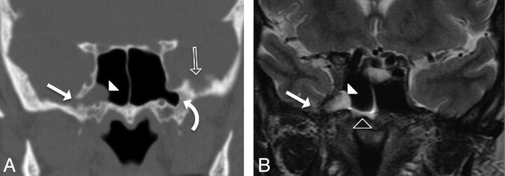 Fig 2.