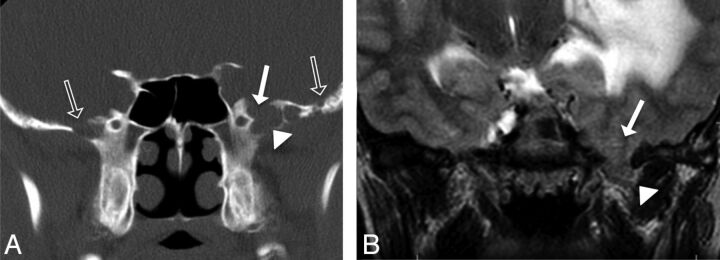 Fig 3.