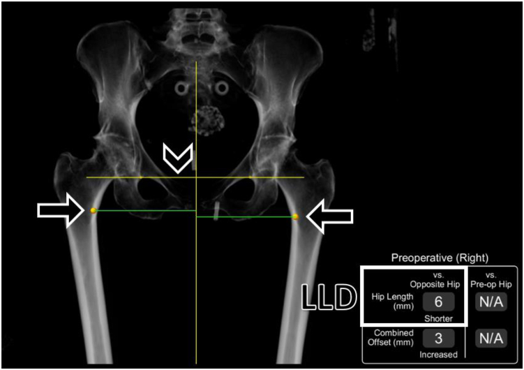 Figure 4