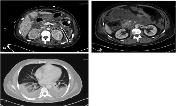 Fig. 1