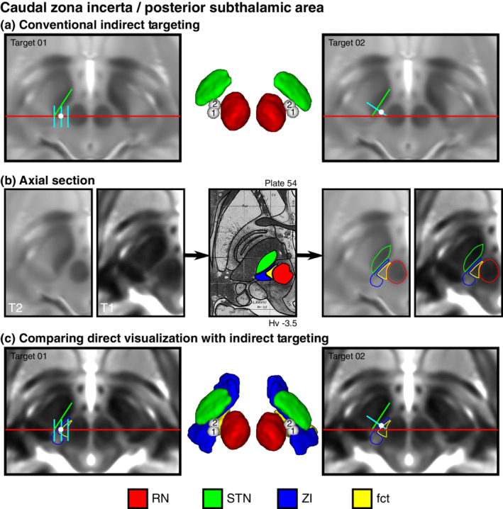 FIGURE 4