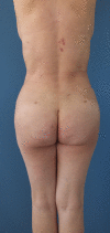 Fig. 20.