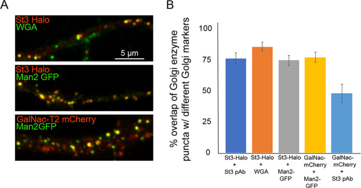 Figure 4—figure supplement 1.