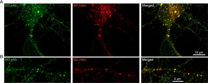 Figure 2—figure supplement 1.