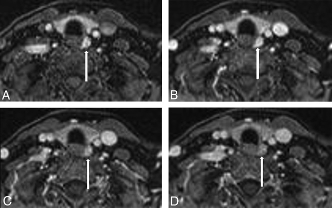 Fig 2.